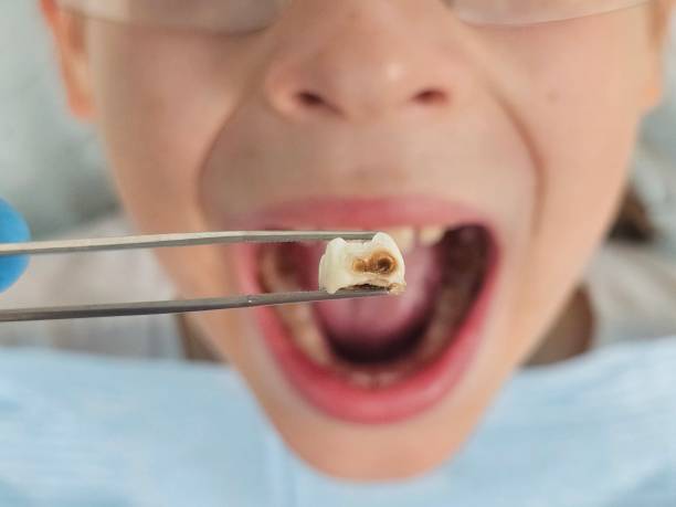 Best Urgent Dental Care for Toothaches in Manchaca, TX